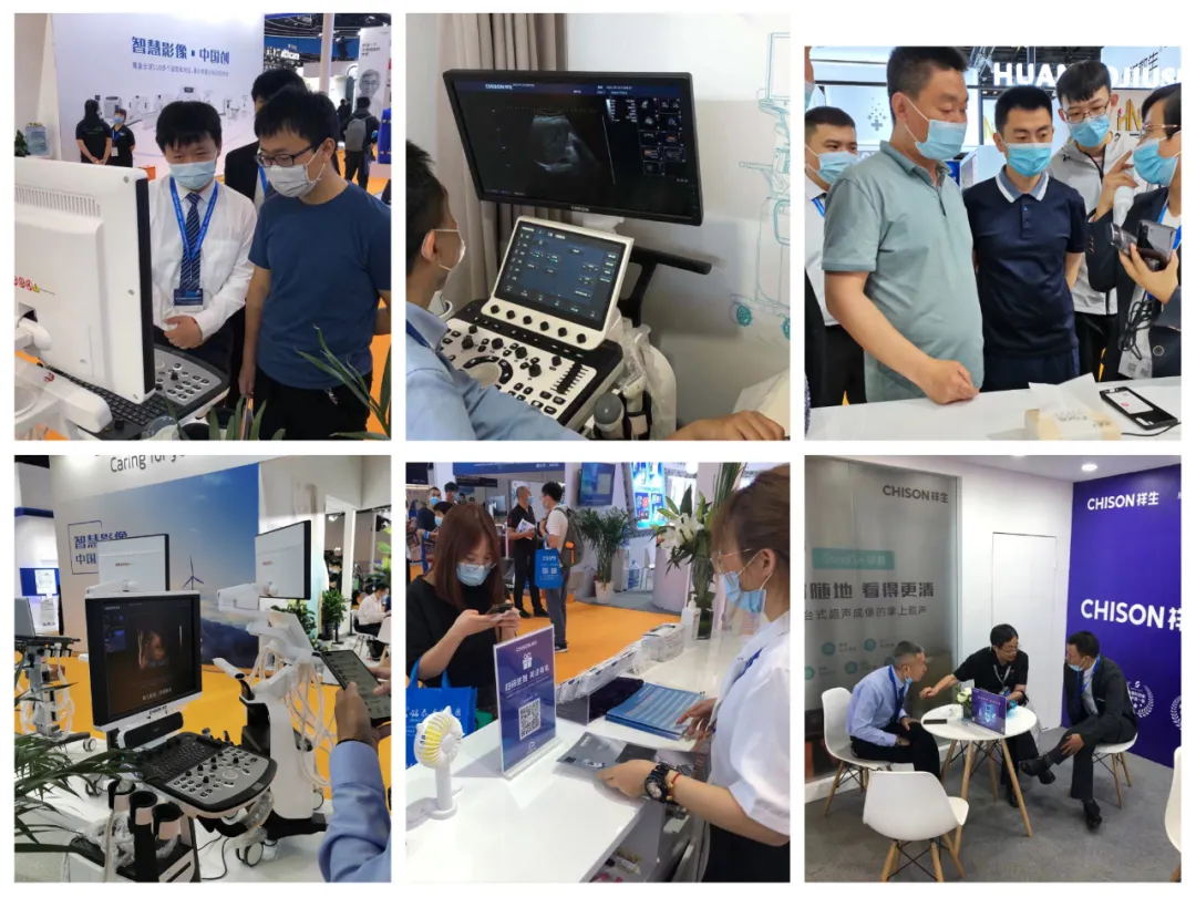 ag贵宾厅医疗超声阵容掀高端智能热潮|2021 CHINA MED