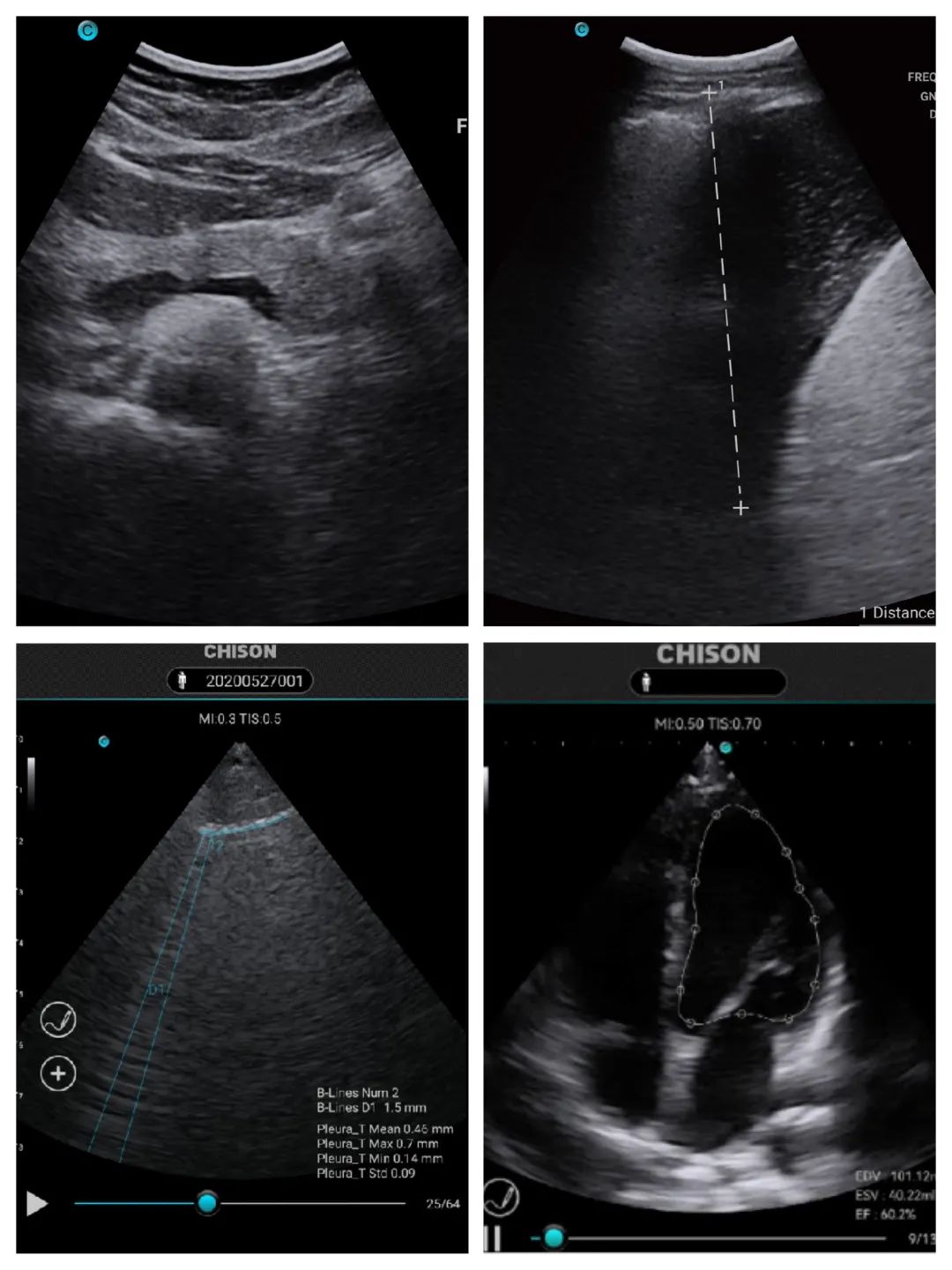 掌超空地救援，带你“穿越”时空！