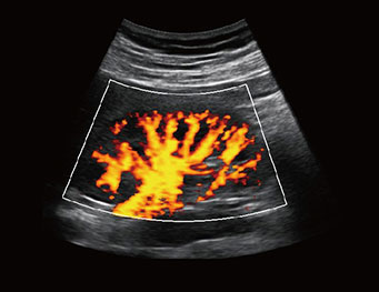 肾脏，PD 模式