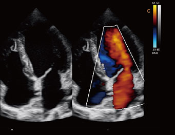 心脏，B BC 模式