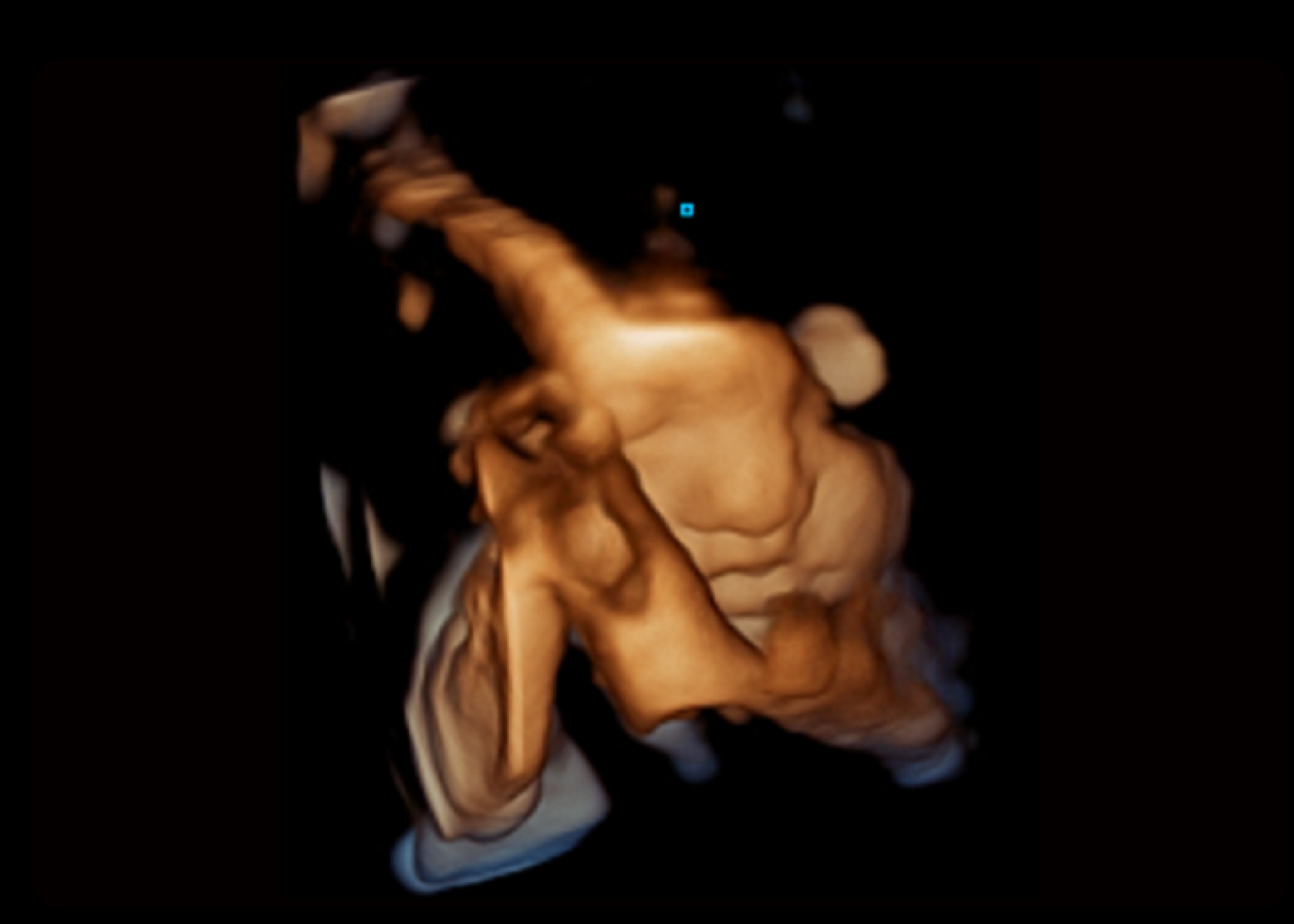 景深成像（Depth View）