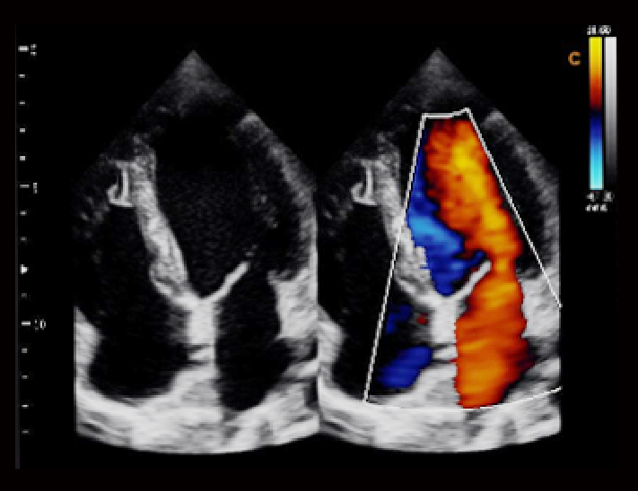 心脏，BC模式